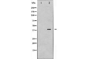 Western blot analysis of AMPK β1 phosphorylation expression in Jurkat whole cell lysates,The lane on the left is treated with the antigen-specific peptide.