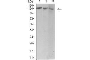Western blot analysis using BCR mouse mAb against Jurkat (1), Hela (2), and Ramos (3) cell lysate.