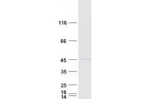 Validation with Western Blot