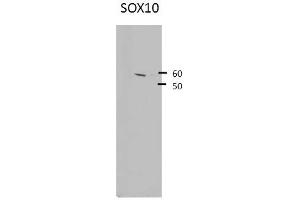 SOX10 antibody - middle region  validated by WB using Hek 293 Whole Cell Lysate at 1:4,000.