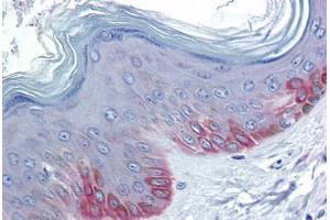 Human Skin: Formalin-Fixed, Paraffin-Embedded (FFPE)