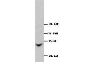 Anti-GJB2 antibody, Western blotting WB: Rat Liver Tissue Lysate