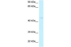 WB Suggested Anti-RPP40 Antibody Titration: 1. (RPP40 anticorps  (N-Term))