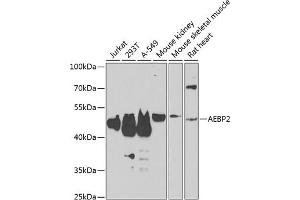 Western blot analysis of extracts of various cell lines, using  antibody (ABIN6131366, ABIN6136608, ABIN6136609 and ABIN6223268) at 1:1000 dilution. (AEBP2 anticorps  (AA 234-503))