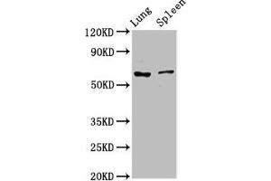 Western Blot Positive WB detected in: Rat lung tissue, Rat spleen tissue All lanes: RIPK2 antibody at 2. (RIPK2 anticorps  (AA 1-540))