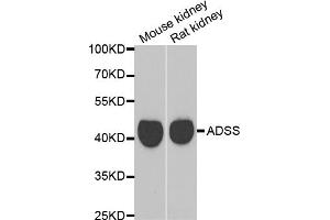 Western blot analysis of extracts of various cell lines, using GATM antibody. (GATM anticorps)