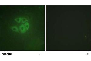 Immunofluorescence analysis of A-549 cells, using PLCB3 polyclonal antibody .