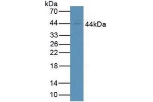 Detection of CD64 in Human Jurkat Cells using Polyclonal Antibody to Cluster Of Differentiation 64 (CD64) (FCGR1A anticorps  (AA 73-294))