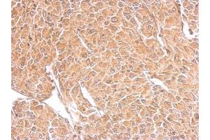 IHC-P Image TSPAN3 antibody detects TSPAN3 protein at cytosol on U87 xenograft by immunohistochemical analysis.