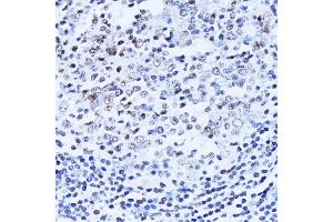 Immunohistochemistry of paraffin-embedded human vermiform appendix using PARP1 Antibody (ABIN5975769) at dilution of 1/100 (40x lens).