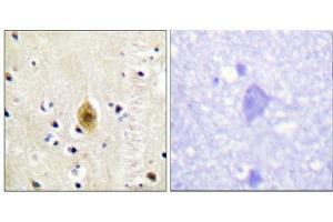 Immunohistochemistry analysis of paraffin-embedded human brain tissue, using Mst1/2 (Phospho-Thr183) antibody.