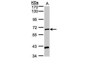 WB Image Sample(30 ug whole cell lysate) A:Hep G2 , 7. (PANK1 anticorps)