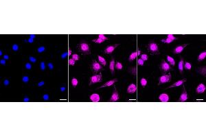 Immunocytochemical staining of HeLa cells with RAVER2 antibody (ABIN7800211), 1:1,000). (Recombinant RAVER2 anticorps)