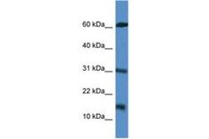 Image no. 1 for anti-Caspase Recruitment Domain Family, Member 17 (CARD17) (AA 51-100) antibody (ABIN6746959) (CARD17 anticorps  (AA 51-100))
