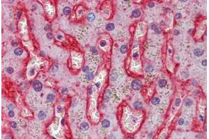 Liver, Human: Formalin-Fixed, Paraffin-Embedded (FFPE)