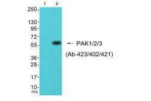 Western blot analysis of extracts from 293 cells (Lane 2), using PAK1/2/3 (Ab-423/402/421) antiobdy.
