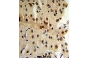 Immunohistochemistry (IHC) image for anti-CAP-GLY Domain Containing Linker Protein 1 (CLIP1) antibody (ABIN3003978)