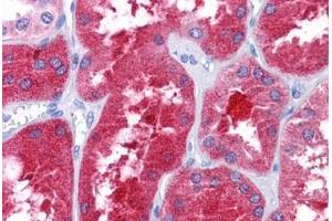 Human Kidney: Formalin-Fixed, Paraffin-Embedded (FFPE) (REEP3 anticorps  (C-Term))