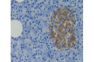 IHC-P analysis of Human Tissue, with DAB staining. (CD81 anticorps  (AA 113-201))