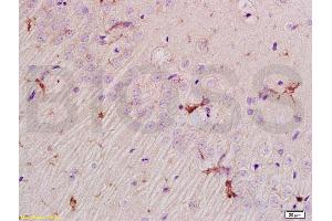Immunohistochemistry (IHC) image for anti-Preferentially Expressed Antigen in Melanoma (PRAME) (AA 151-250) antibody (ABIN721555) (PRAME anticorps  (AA 151-250))