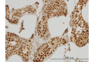 Immunoperoxidase of monoclonal antibody to RAD18 on formalin-fixed paraffin-embedded human testis.