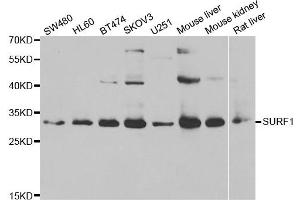 Western blot analysis of extracts of various cell lines, using SURF1 antibody. (SURF1 anticorps)