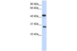 CDCA5 antibody used at 1 ug/ml to detect target protein. (CDCA5 anticorps  (Middle Region))