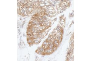 anti-Eukaryotic Translation Initiation Factor 3, Subunit B (EIF3B) (AA 100-150) antibody