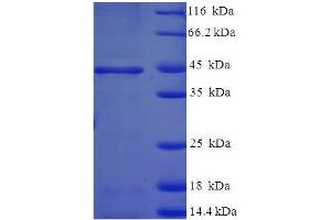 SDS-PAGE (SDS) image for 17-beta-Hydroxysteroid Dehydrogenase 14 (DHB14) (AA 1-270), (full length) protein (His-SUMO Tag) (ABIN5711729) (DHB14 Protein (AA 1-270, full length) (His-SUMO Tag))