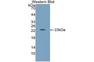 Western Blotting (WB) image for anti-Hexosaminidase B (Beta Polypeptide) (HEXB) (AA 122-311) antibody (ABIN3208194) (HEXB anticorps  (AA 122-311))