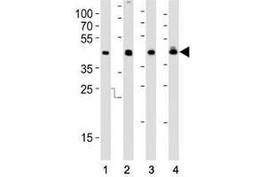 Western blot analysis of lysate from (1) HepG2, (2) MCF-7 cell line, (3) human liver and (4) rat liver tissue using IDH1 antibody at 1:1000. (IDH1 anticorps  (AA 116-143))