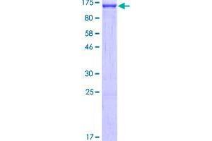Image no. 1 for Staphylococcal Nuclease Domain Containing Protein 1 (SND1) (AA 1-910) protein (GST tag) (ABIN1320790)
