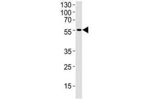Western blot analysis of human brain tissue lysate using DCX antibody at 1:1000.