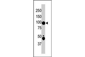 The MAP4K2 polyclonal antibody  is used in Western blot to detect MAP4K2 in mouse skeletal muscle tissue lysate . (MAP4K2 anticorps  (Internal Region))