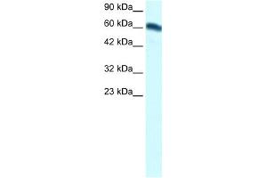 WB Suggested Anti-FOXC2 Antibody Titration:  1. (FOXC2 anticorps  (Middle Region))