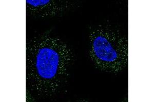 Immunofluorescent staining of human cell line A-431 with WDR48 polyclonal antibody  at 1-4 ug/mL dilution shows positivity in vesicles. (WDR48 anticorps)