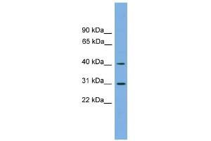 WB Suggested Anti-HSD3B7 Antibody Titration:  0.