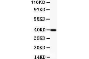 Anti-IKK alpha Picoband antibody,  All lanes: Anti IKKA  at 0. (IKK alpha anticorps  (AA 411-745))