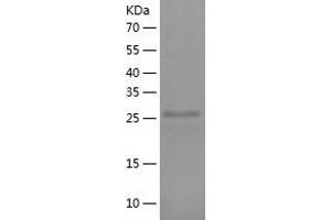 Western Blotting (WB) image for BTB (POZ) Domain-Containing Protein KCTD4 (KCTD4) (AA 1-259) protein (His-IF2DI Tag) (ABIN7122054)
