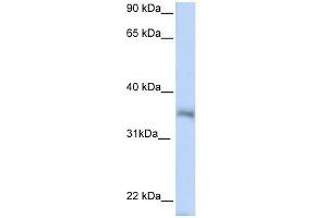 HEXIM2 antibody used at 1 ug/ml to detect target protein. (HEXIM2 anticorps  (N-Term))