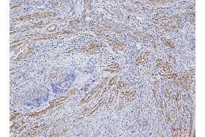 IHC analysis of CD35 using anti-CD35 antibody (ABIN7599703).