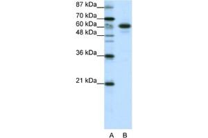 Western Blotting (WB) image for anti-Cas-Br-M (Murine) Ecotropic Retroviral Transforming Sequence-Like 1 (CBLL1) antibody (ABIN2461939) (CBLL1 anticorps)