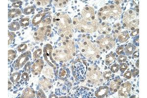 PPIE antibody was used for immunohistochemistry at a concentration of 4-8 ug/ml to stain Epithelial cells of renal tubule (arrows) in Human Kidney.