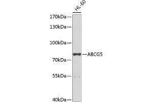 Western blot analysis of extracts of HL-60 cells, using  antibody (ABIN6134210, ABIN6136382, ABIN6136383 and ABIN6224696) at 1:1000 dilution. (ABCG5 anticorps  (AA 350-450))