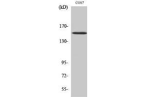Western Blotting (WB) image for anti-phospholipase C, gamma 1 (PLCG1) (pTyr771) antibody (ABIN3173207) (Phospholipase C gamma 1 anticorps  (pTyr771))