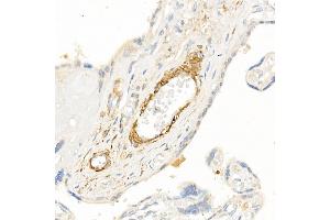 Immunohistochemistry of paraffin-embedded human placenta using TAGLN Rabbit pAb (ABIN6128763, ABIN6148829, ABIN6148830 and ABIN6222495) at dilution of 1:25 (40x lens). (Transgelin anticorps  (AA 1-201))