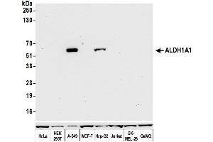 Western Blotting (WB) image for anti-Aldehyde Dehydrogenase 1 Family, Member A1 (ALDH1A1) (AA 300-350) antibody (ABIN7453956)