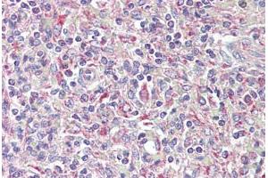 Anti-TRIB1 antibody IHC staining of human spleen. (TRIB1 anticorps  (AA 353-366))