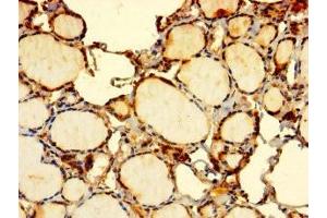 Immunohistochemistry of paraffin-embedded human thyroid tissue using ABIN7151974 at dilution of 1:100