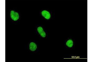 Immunofluorescence of purified MaxPab antibody to UBE2S on HeLa cell. (UBE2S anticorps  (AA 1-222))